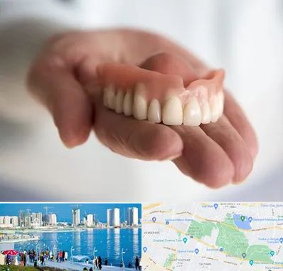 لیفت لثه با لیزر در چیتگر 