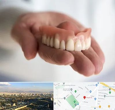 لیفت لثه با لیزر در هنگام