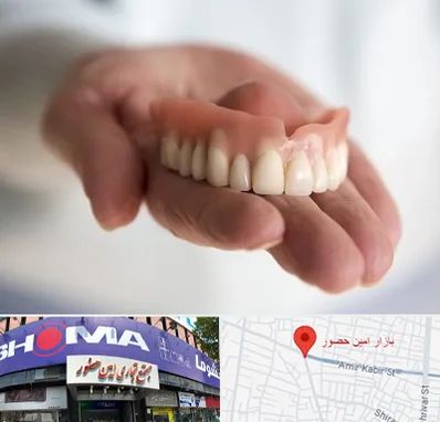 لیفت لثه با لیزر در امین حضور