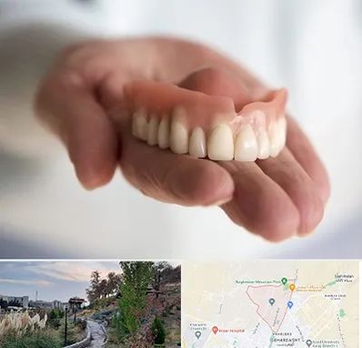 لیفت لثه با لیزر در باغستان کرج