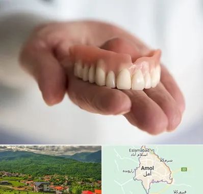 لیفت لثه با لیزر در آمل