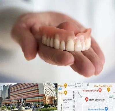 لیفت لثه با لیزر در سهروردی 