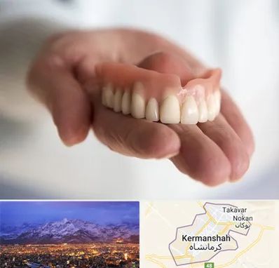 لیفت لثه با لیزر در کرمانشاه