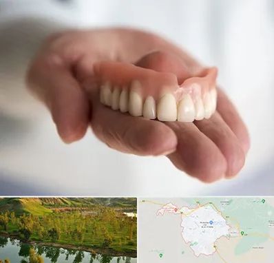 لیفت لثه با لیزر در بهبهان