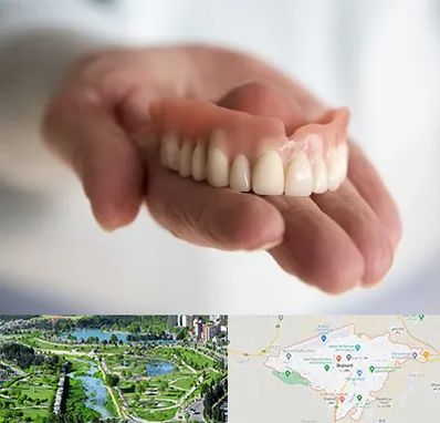 لیفت لثه با لیزر در بجنورد