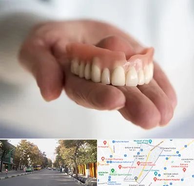 لیفت لثه با لیزر در شریعتی 