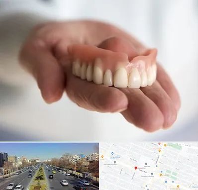 لیفت لثه با لیزر در بلوار معلم مشهد