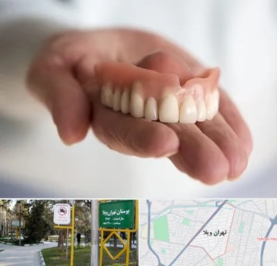 لیفت لثه با لیزر در تهران ویلا