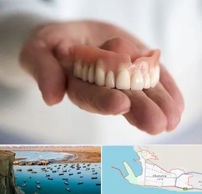 لیفت لثه با لیزر در چابهار