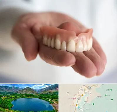 لیفت لثه با لیزر در رودبار