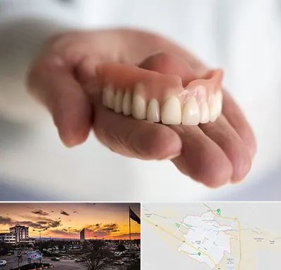 لیفت لثه با لیزر در قوچان