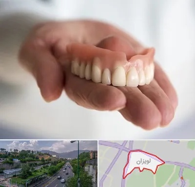لیفت لثه با لیزر در لویزان