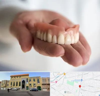 لیفت لثه با لیزر در زنبیل آباد قم