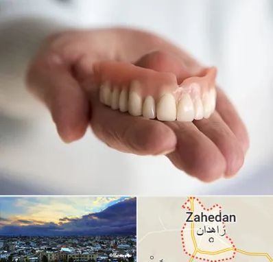 لیفت لثه با لیزر در زاهدان