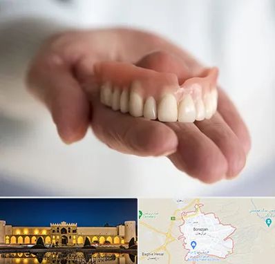 لیفت لثه با لیزر در برازجان