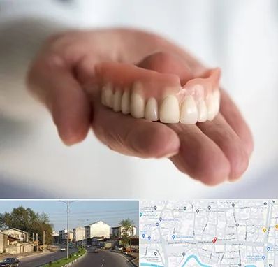 لیفت لثه با لیزر در ضیابری رشت