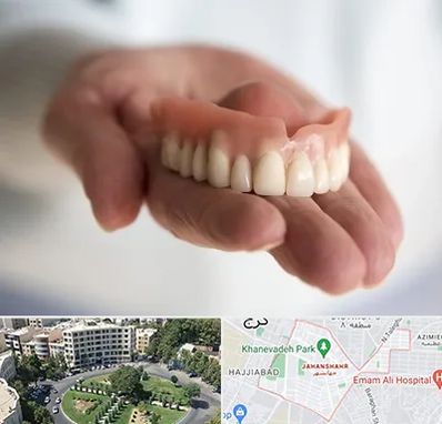 لیفت لثه با لیزر در جهانشهر کرج 