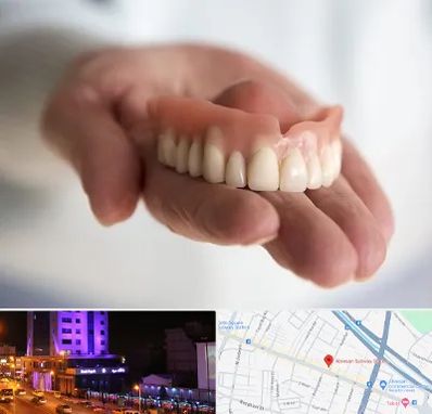 لیفت لثه با لیزر در آبرسان تبریز