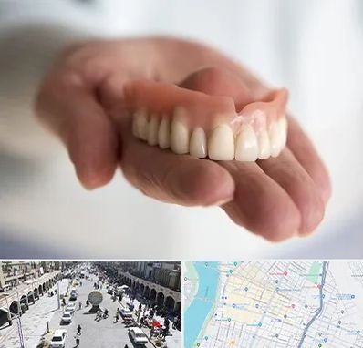 لیفت لثه با لیزر در نادری اهواز