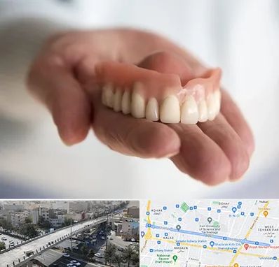 لیفت لثه با لیزر در فرجام