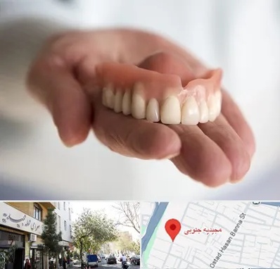 لیفت لثه با لیزر در مجیدیه جنوبی