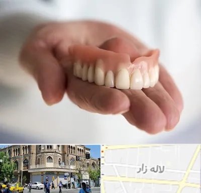 لیفت لثه با لیزر در لاله زار
