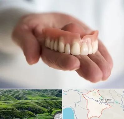 لیفت لثه با لیزر در گچساران