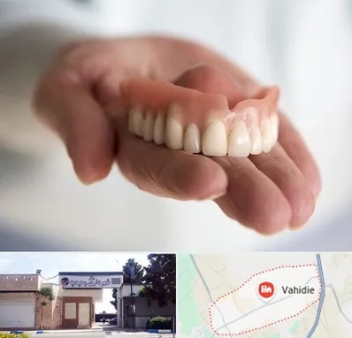لیفت لثه با لیزر در وحیدیه شهریار