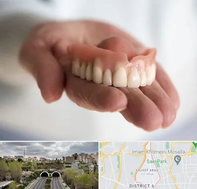 لیفت لثه با لیزر در یوسف آباد 