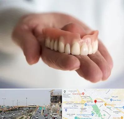 لیفت لثه با لیزر در بلوار توس مشهد