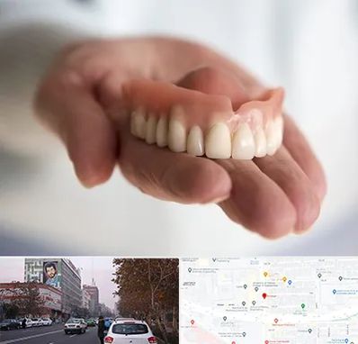 لیفت لثه با لیزر در کارگر شمالی