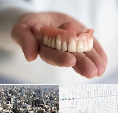 لیفت لثه با لیزر در جیحون