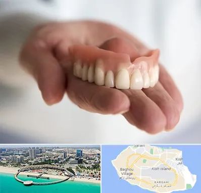 لیفت لثه با لیزر در کیش