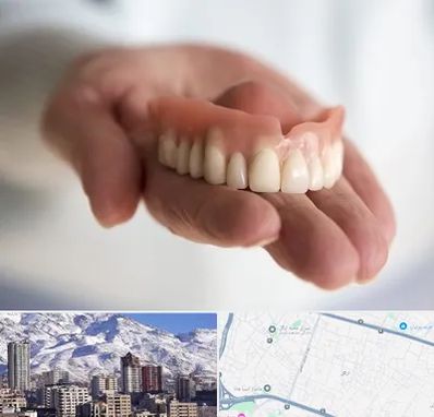 لیفت لثه با لیزر در ازگل