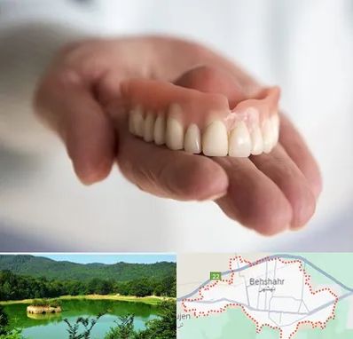 لیفت لثه با لیزر در بهشهر