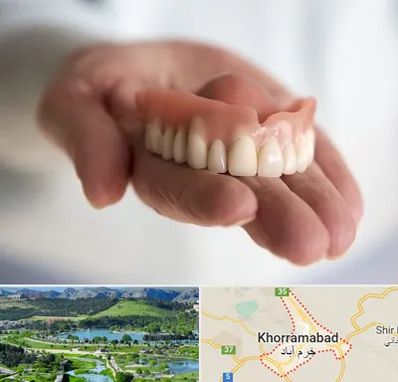 لیفت لثه با لیزر در خرم آباد