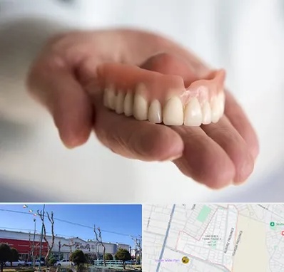 لیفت لثه با لیزر در فاز دو اندیشه