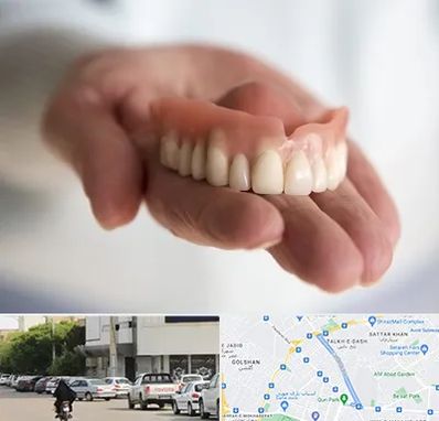 لیفت لثه با لیزر در قدوسی شرقی شیراز