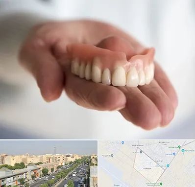 لیفت لثه با لیزر در کیانمهر کرج