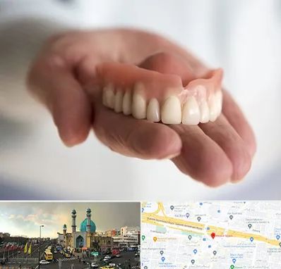 لیفت لثه با لیزر در رسالت