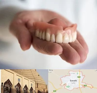 لیفت لثه با لیزر در ساوه