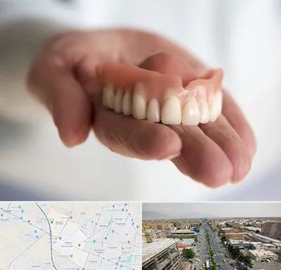 لیفت لثه با لیزر در حصارک کرج