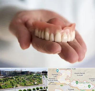 لیفت لثه با لیزر در پردیس