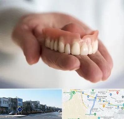 لیفت لثه با لیزر در شریعتی مشهد