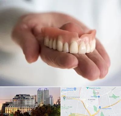 لیفت لثه با لیزر در فرشته 