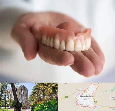 لیفت لثه با لیزر در نیشابور