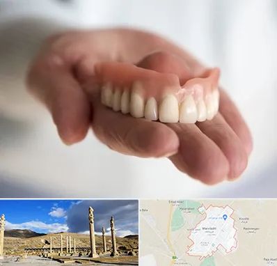 لیفت لثه با لیزر در مرودشت