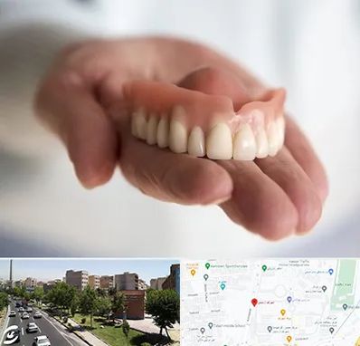 لیفت لثه با لیزر در شهرک آزمایش