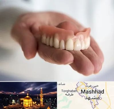 لیفت لثه با لیزر در مشهد