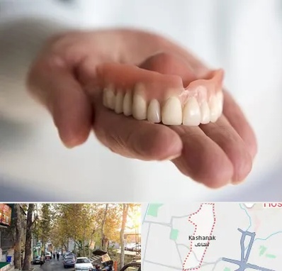 لیفت لثه با لیزر در کاشانک
